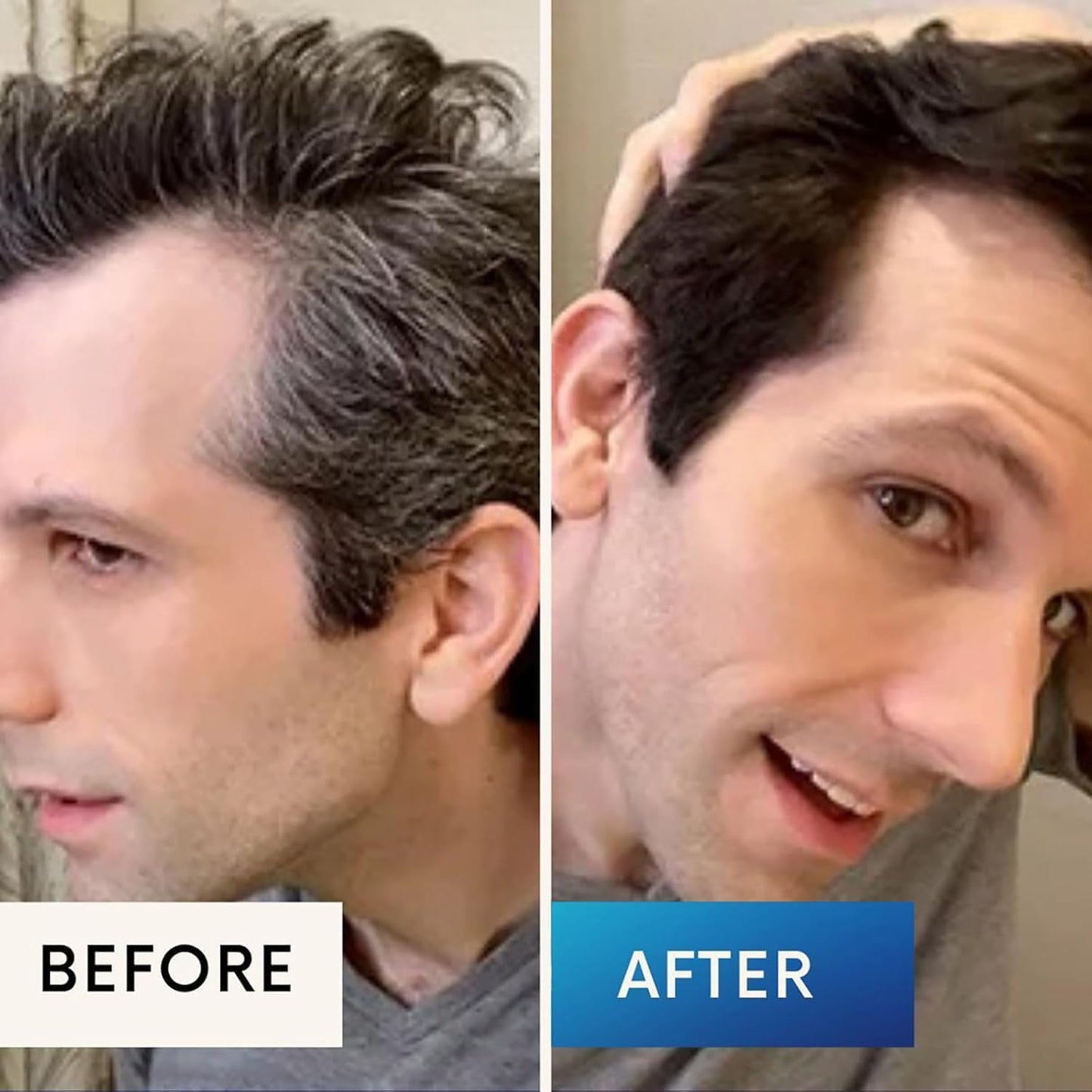 Krey Black Gray Hair Serum – Revive Your Natural Hair Color!