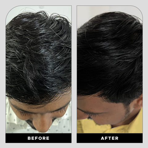 Krey Black Gray Hair Serum – Revive Your Natural Hair Color!