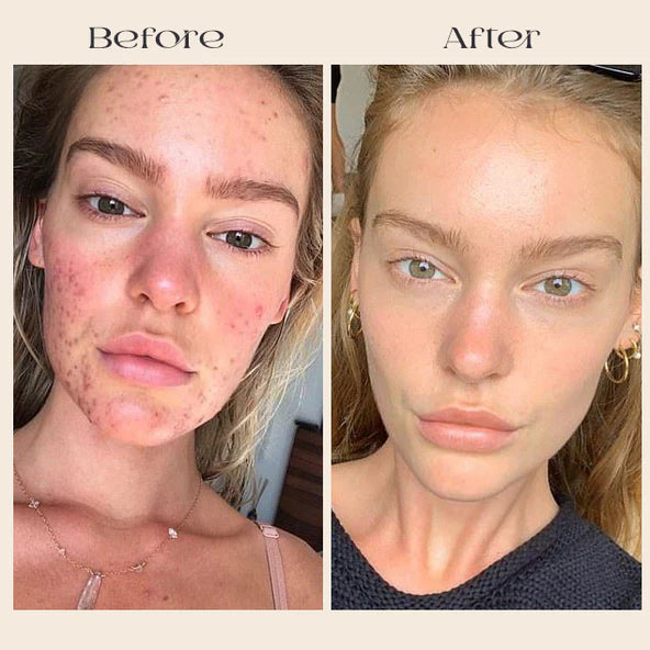 Deep Collagen Mask