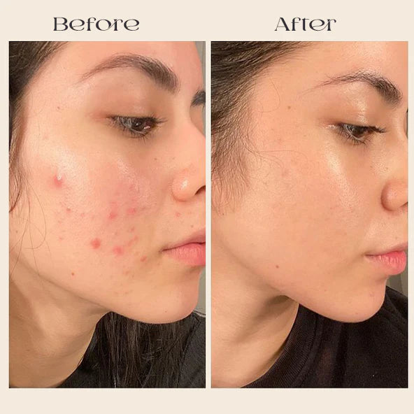 Deep Collagen Mask