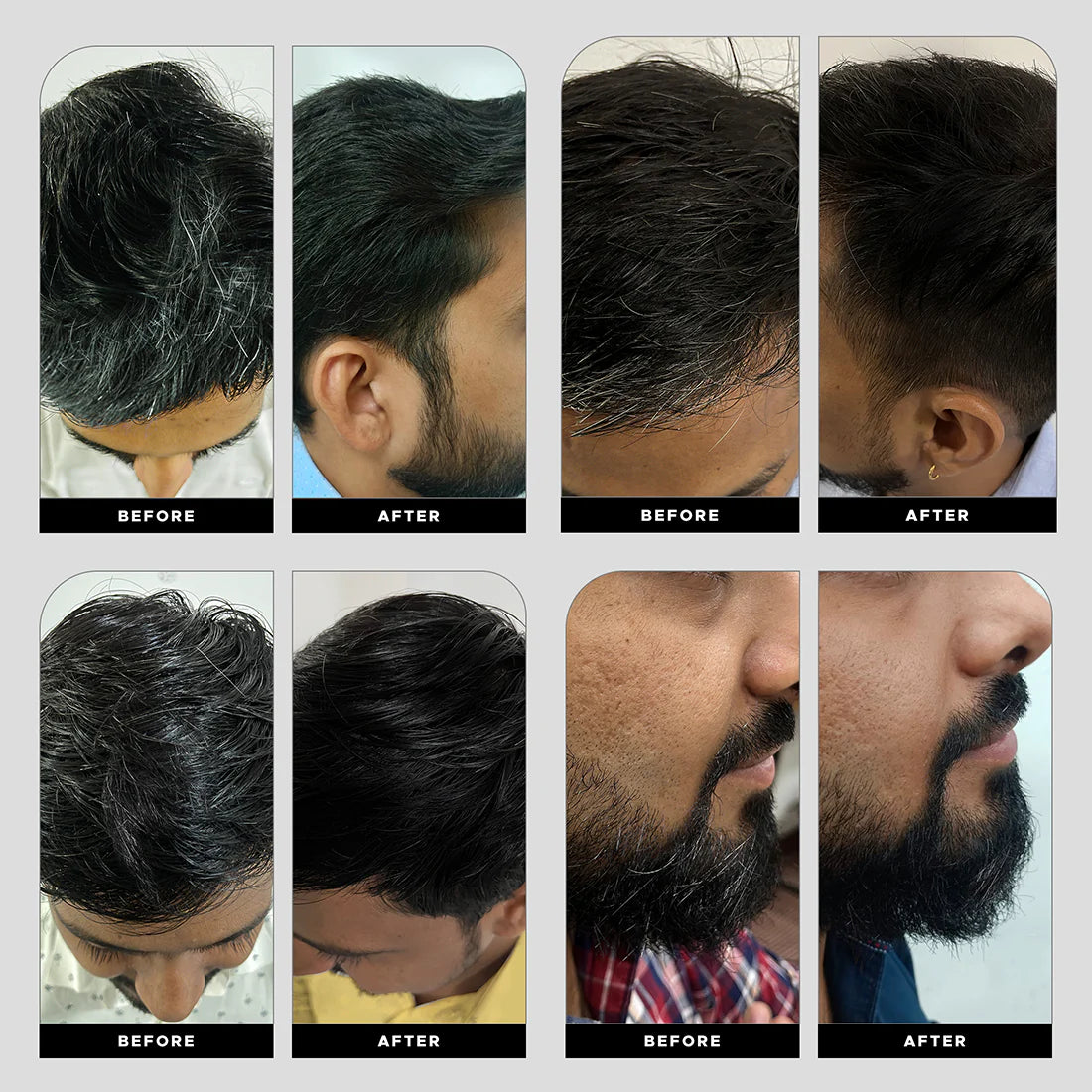 Krey Black Gray Hair Serum – Revive Your Natural Hair Color!