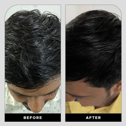 Krey Black  Gray Hair Serum – Revive Your Natural Hair Color!