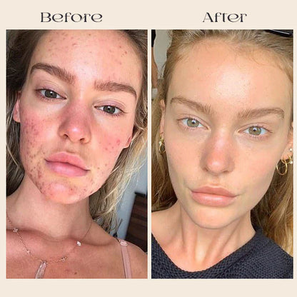 Deep Collagen Mask