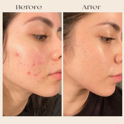 Deep Collagen Mask