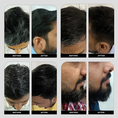 Krey Black  Gray Hair Serum – Revive Your Natural Hair Color!